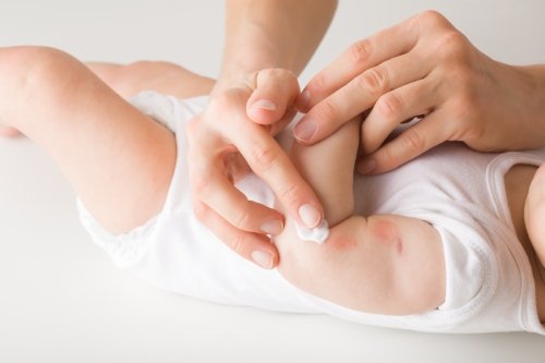 12 Penyebab Bruntusan pada Bayi dan Cara Mengatasinya - Nutriclub