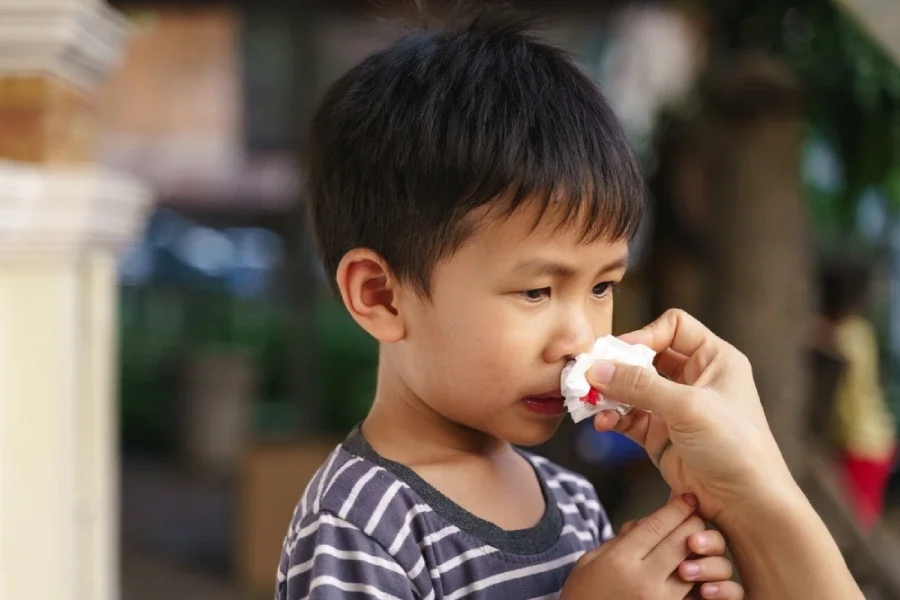 Mimisan pada anak - Nutriclub