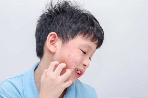 Penyebab Alergi pada Anak​ - Nutriclub