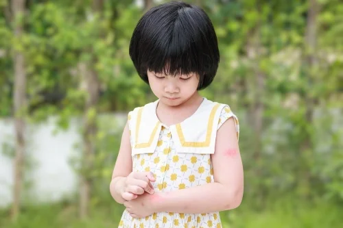 Pola Makan Sehat untuk anak yang alergi - Nutri