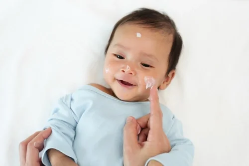 Cara mengatasi kulit kering pada bayi - nutriclub