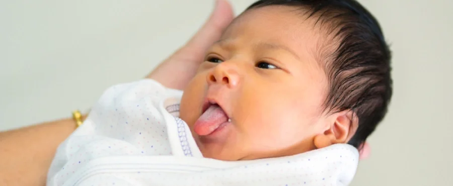 lidah bayi putih-nutriclub