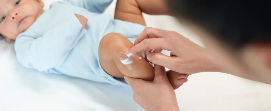 Mencegah alergi pada bayi-nutriclub