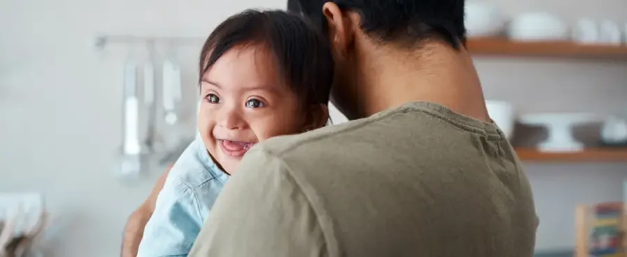 penyebab down syndrome pada bayi-nutriclub