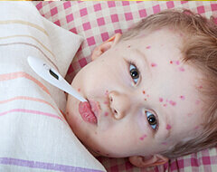 tips-mencegah-dan-mengurangi-risiko-alergi-pada-si-kecil_small