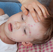 kenali-faktor-penyebab-alergi-pada-si-kecil_medium | © kenali-faktor-penyebab-alergi-pada-si-kecil_medium
